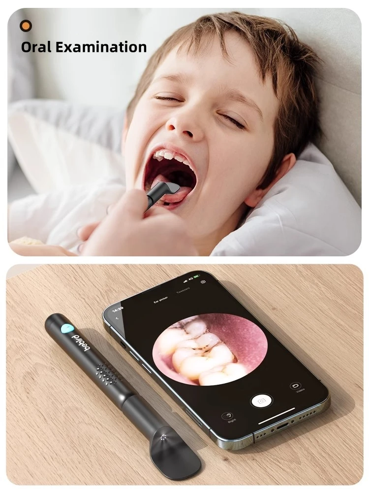 Bebird R3 Ear Cleaner Smart Vi – Pet Ear Cleaner recenzja i cena