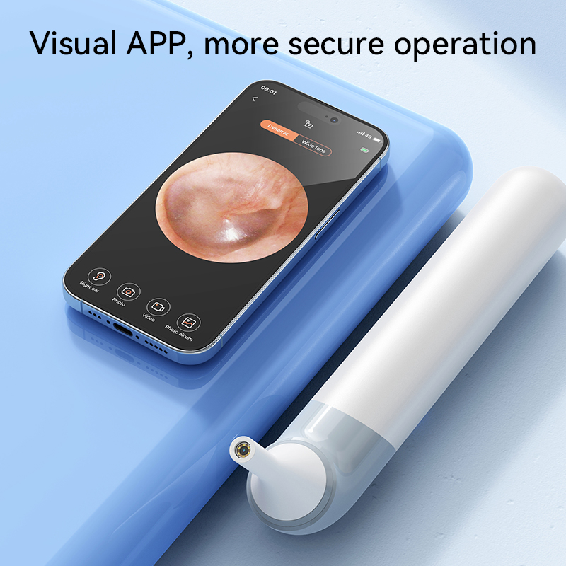 Inteligentny czyścik do uszu 3 – Pet Ear Cleaner recenzja i cena